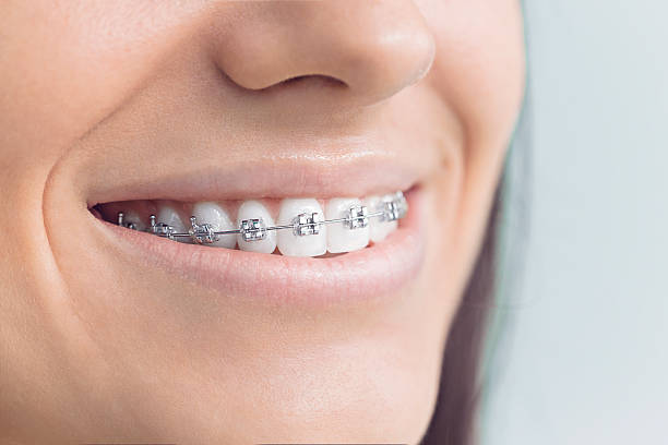 Best Dental Inlays and Onlays  in Hull, IA